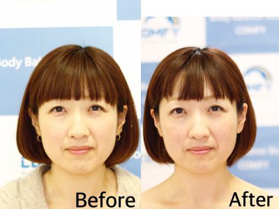 小顔トレーニング