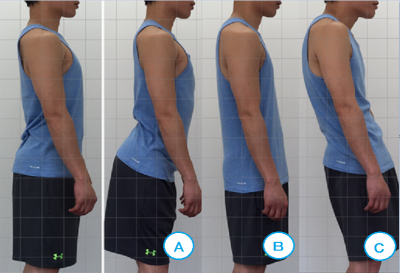ヒップアップと骨盤3つの傾き