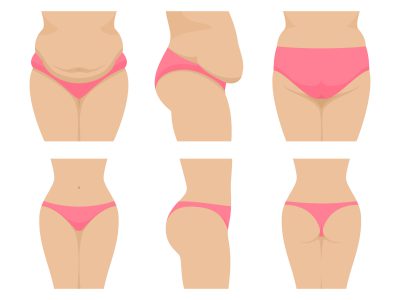 藤沢 パーソナルトレーニング くびれないデメリット
