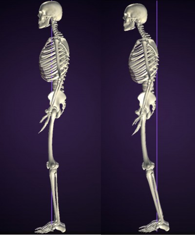 ヒップアップトレーニング 姿勢(筋肉バランス)分析 骨