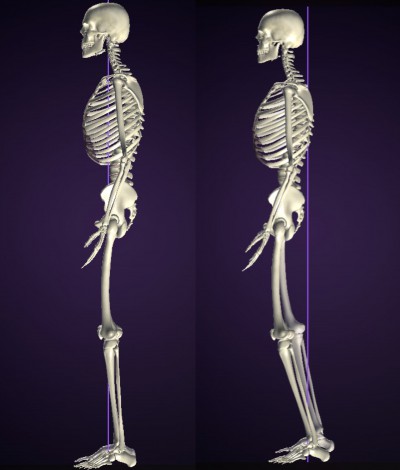 【お客様の声】バランストレーニング Kさん①