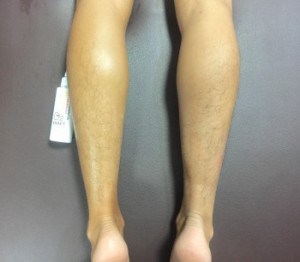 【塗る酸素】筋肉を柔らかくするオイル