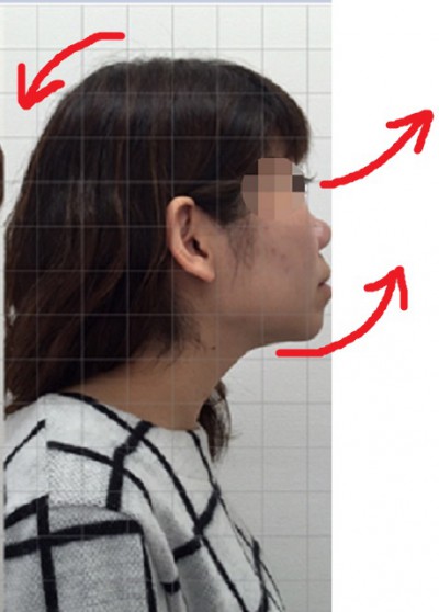バランス感覚の向上は目線と首トレ 頭頂を伸ばす