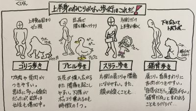 4タイプのねじり不足歩行