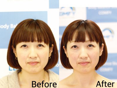 首トレで小顔
