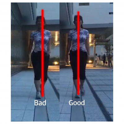 ウォーキングと骨盤・身体の歪み 事例