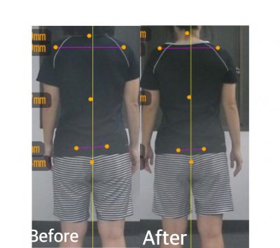 ウォーキングで太もも痩せ A様