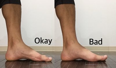 美脚 浮き指の状態 横から