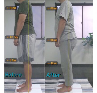 藤沢 パーソナルトレーニング Dさん Before&After3