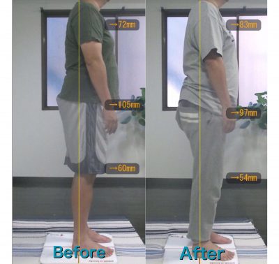 藤沢 パーソナルトレーニング Dさん Before&After4