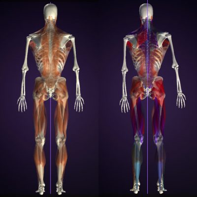 ウォーキング姿勢 事例 後