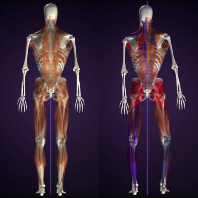 ウォーキング姿勢 事例紹介 後