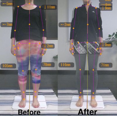 Before＆After1 前側