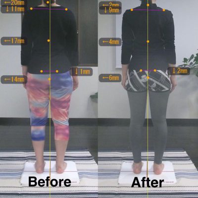 Before＆After1 後ろ側