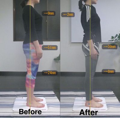 Before＆After1 側面 右