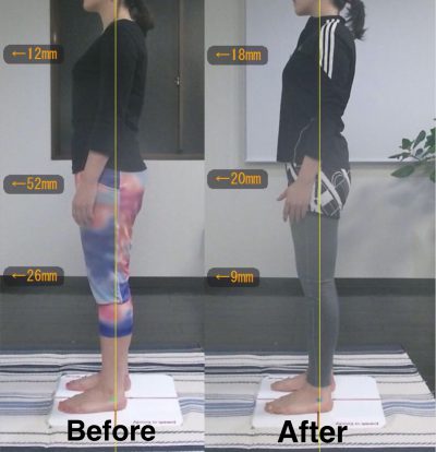 Before＆After1 側面 左