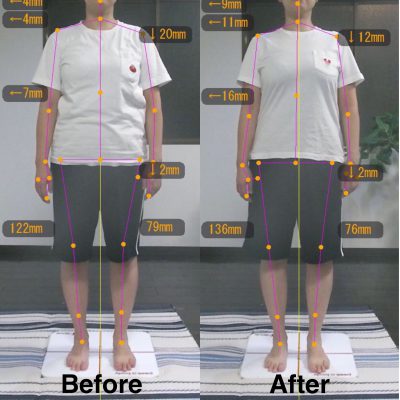 お客様の声 Y様 前側