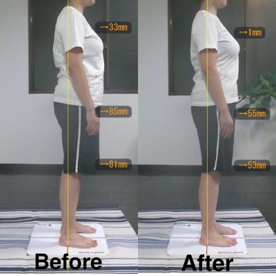 お客様の声 Y様 側面右