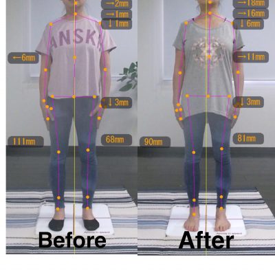 【2ヶ月】Before＆After 前