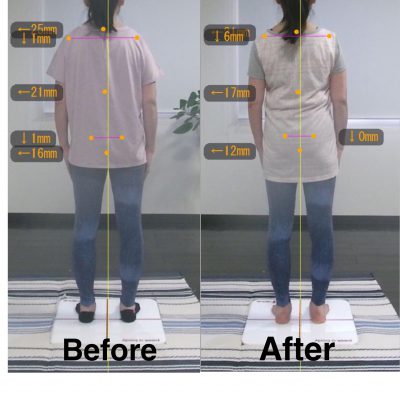 【2ヶ月】Before＆After 後ろ