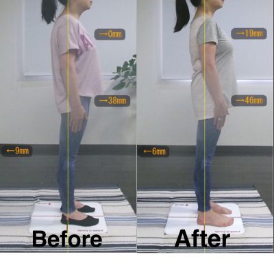 【2ヶ月】Before＆After 右