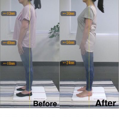 【2ヶ月】Before＆After 左