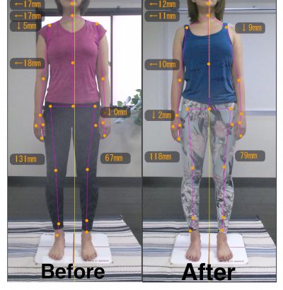 【5ヶ月】Before＆After 前