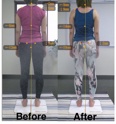 【5ヶ月】Before＆After 後ろ