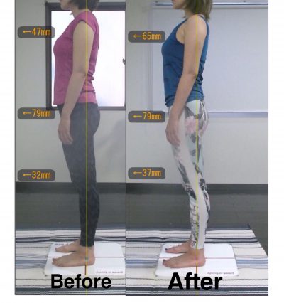 【5ヶ月】Before＆After 左