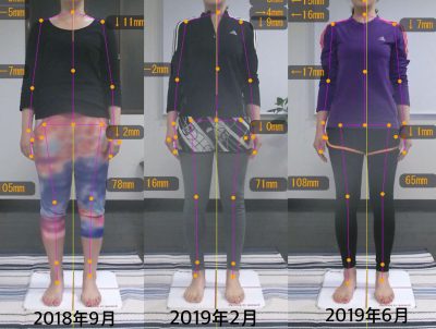 【10ヶ月】Before&After 前