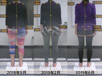【10ヶ月】Before&After 後ろ