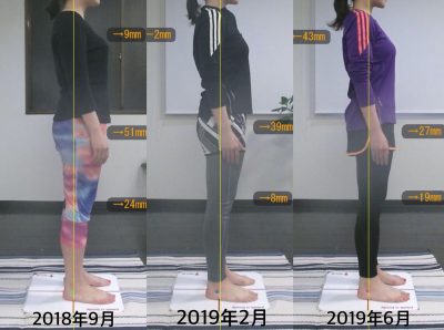 【10ヶ月】Before&After 右