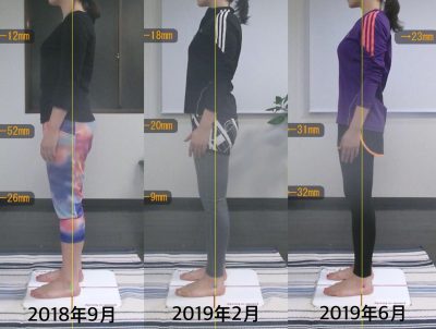 【10ヶ月】Before&After 左
