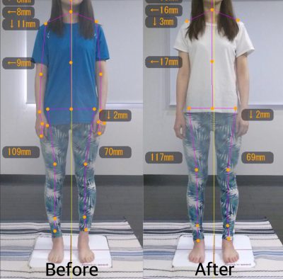 【3ヶ月】Before&After 前