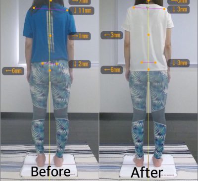 【3ヶ月】Before&After 後ろ