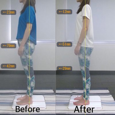 【3ヶ月】Before&After 左