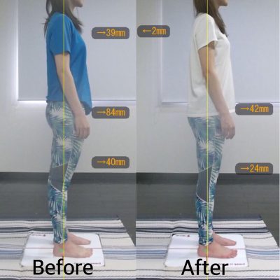 【3ヶ月】Before&After 右