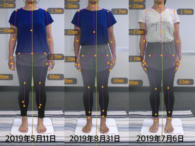 お客様の声 S様 前