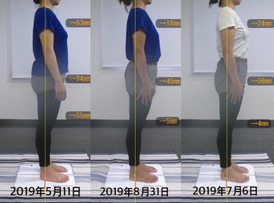 お客様の声 S様 右