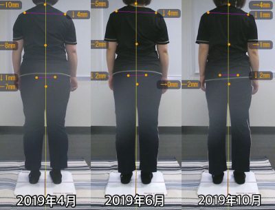 お客様の声 N様 後