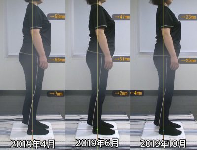 お客様の声 N様 右