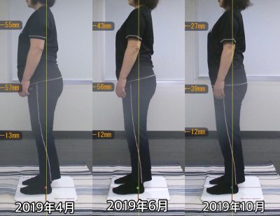 お客様の声 N様 左