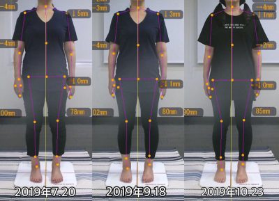 お客様の声 A様 前