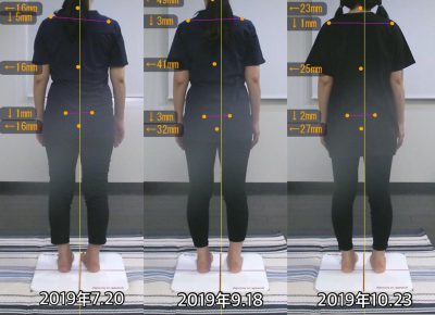 お客様の声 A様 後