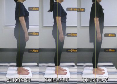 お客様の声 A様 右 