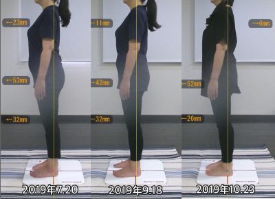 お客様の声 A様 左