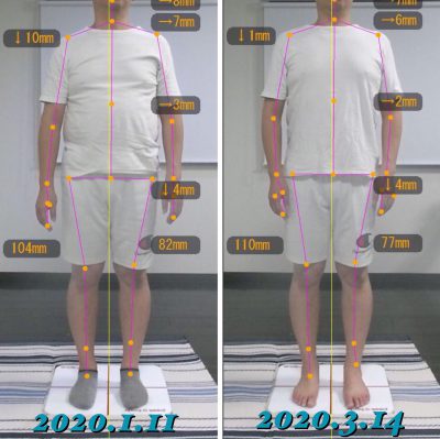 お客様の声 D様 前