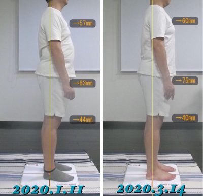 お客様の声 D様 右