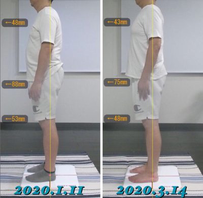 お客様の声 D様 左